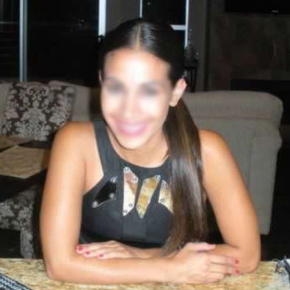 Gucci Mini Dress - Picture 2 of 9